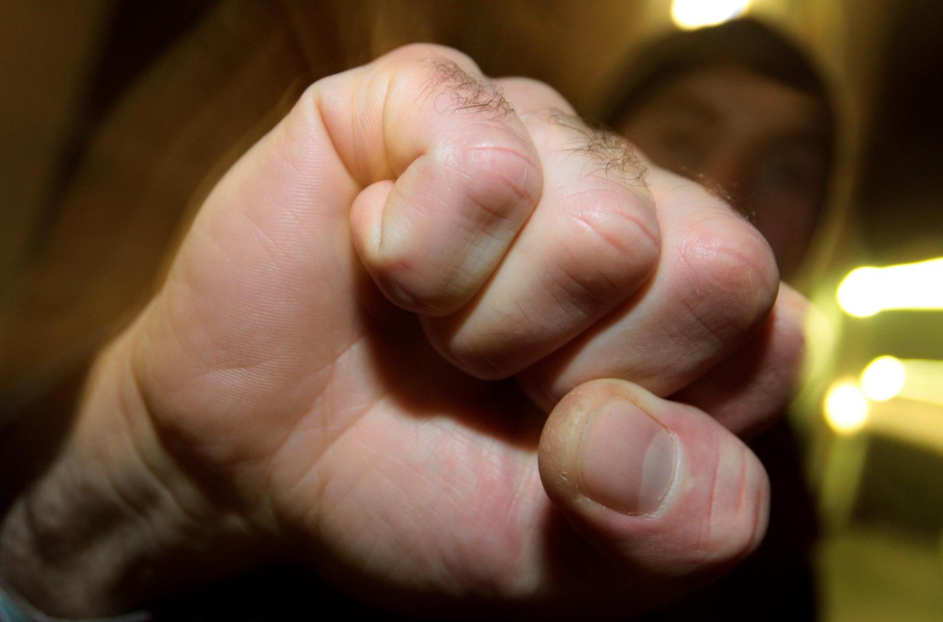 Ein Junge solle einem 12-Jährigen auf dem Frohnbergfest ins Gesicht geschlagen haben.  (Bild: Karl-Josef Hildenbrand, dpa)