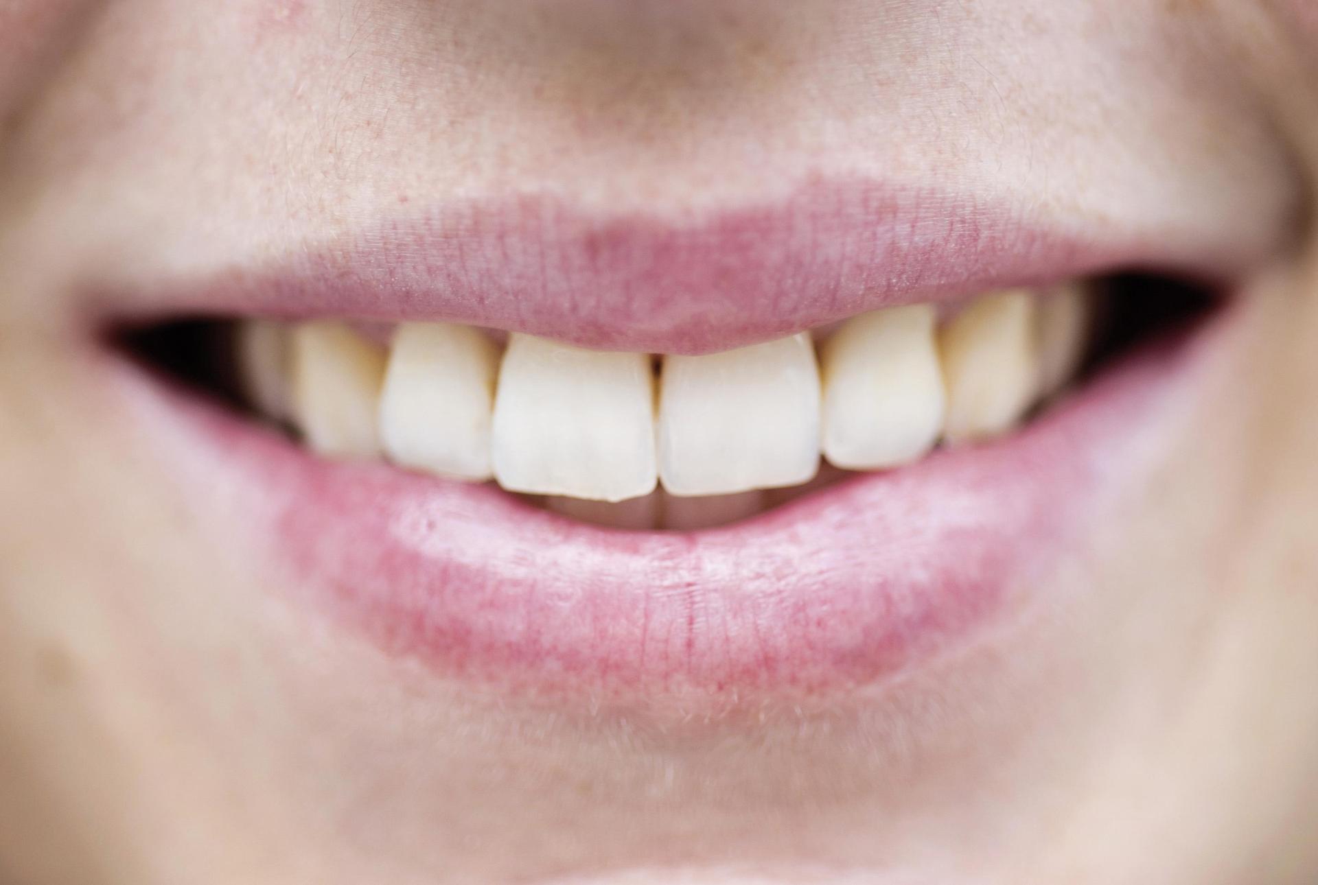 Nach Angaben der Polizei ermittelt die Polizeiinspektion Amberg nach einer misslungenen Lippenbehandlung in Nürnberg wegen des Verdachts der Körperverletzung. (Symbolbild: Victoria Bonn-Meuser)