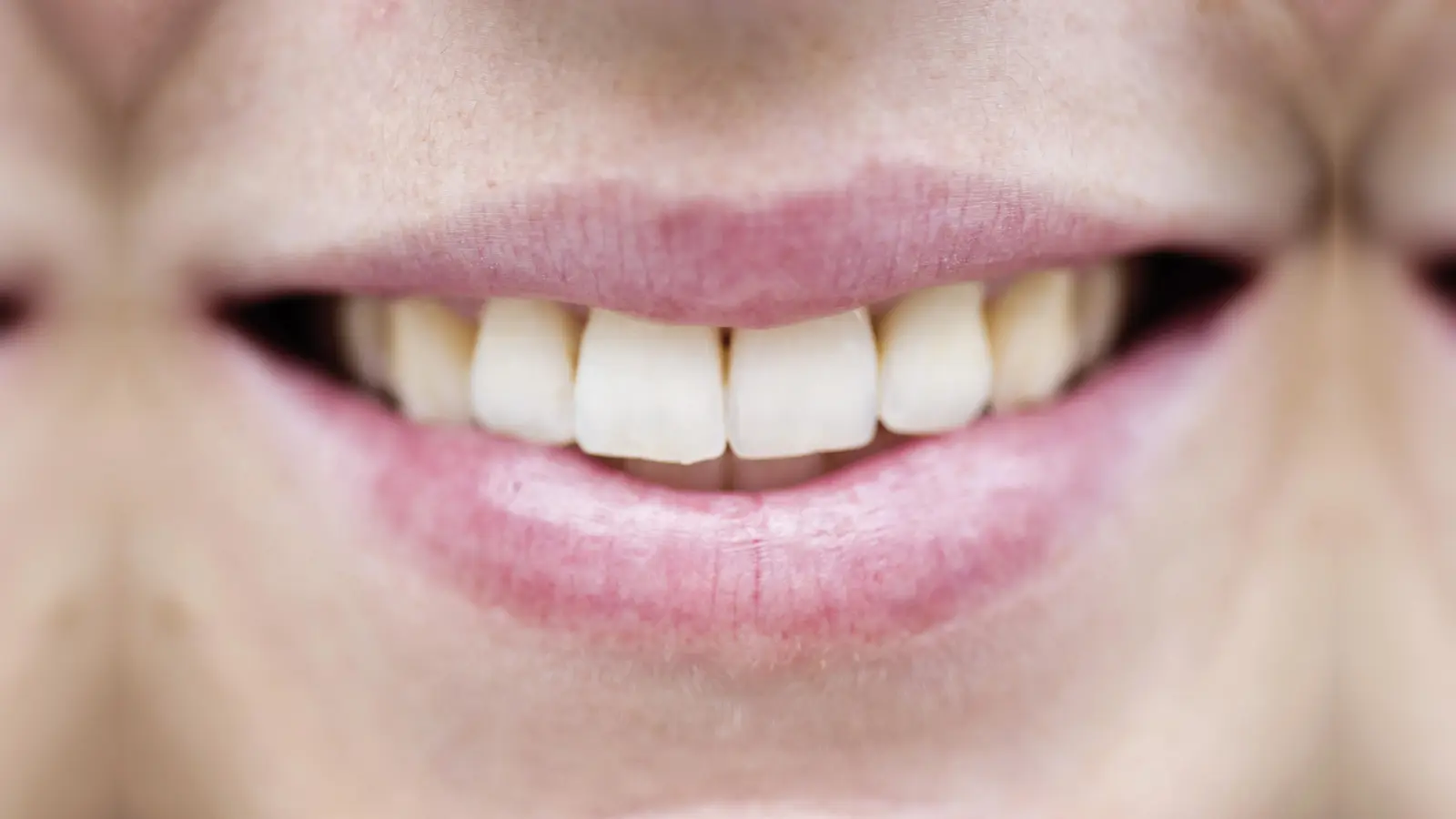 Nach Angaben der Polizei ermittelt die Polizeiinspektion Amberg nach einer misslungenen Lippenbehandlung in Nürnberg wegen des Verdachts der Körperverletzung. (Symbolbild: Victoria Bonn-Meuser)