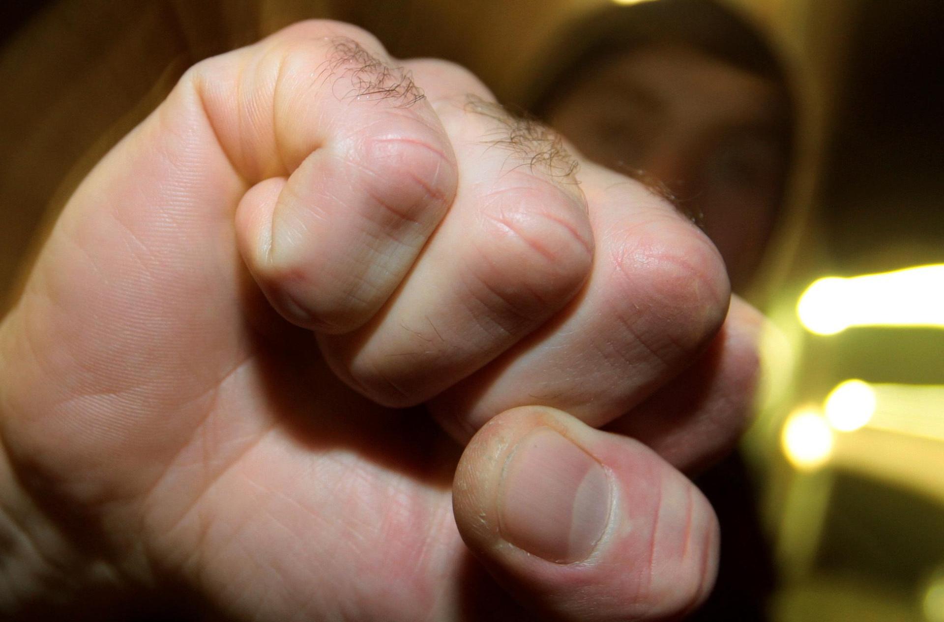 Die Polizei hatte es in Schmidmühlen mit einem ziemlich aggressiven 52-Jährigen zu tun.  (Symbolbild: Karl-Josef Hildenbrand/dpa)